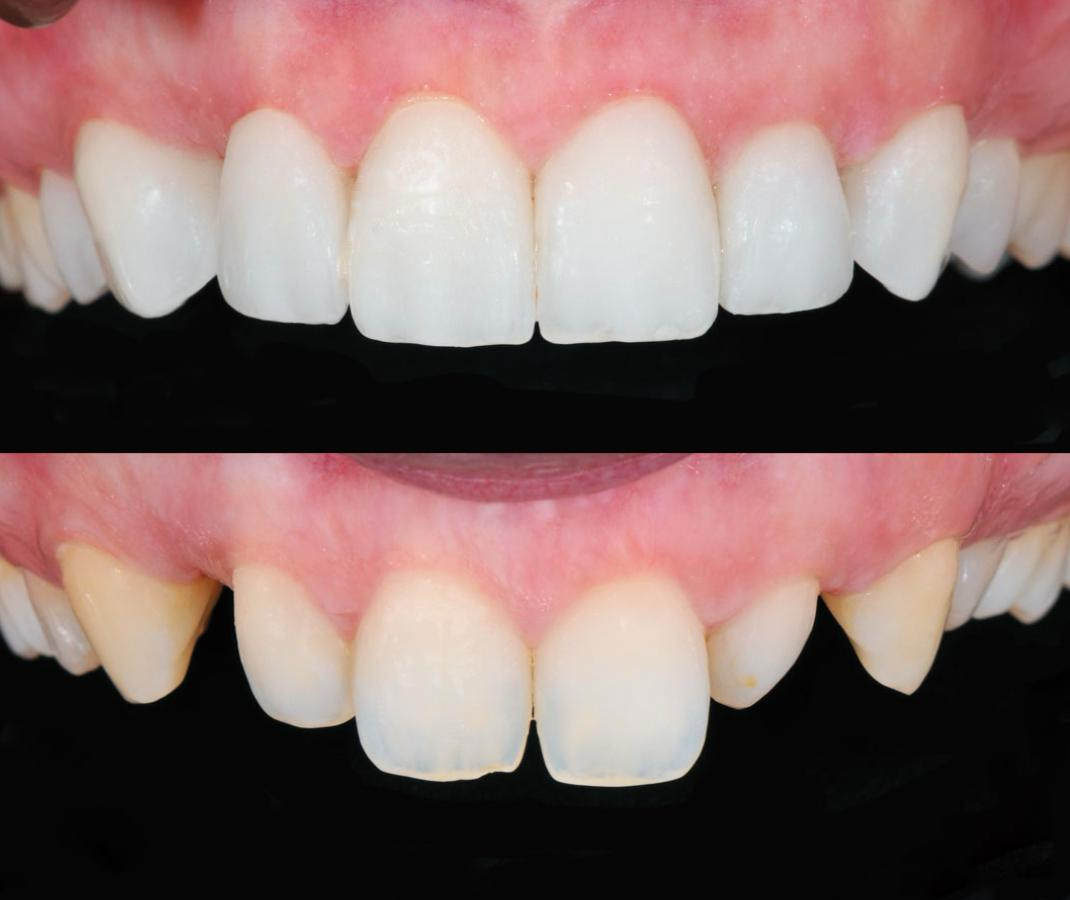 Estética dental
